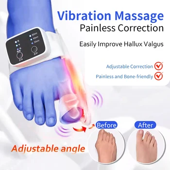 Electri Toe Separator Bunion Splint Straightener Corrector Hallux Valgus Protector Toe Orthotics Braces Bunion Toe Corrector 1