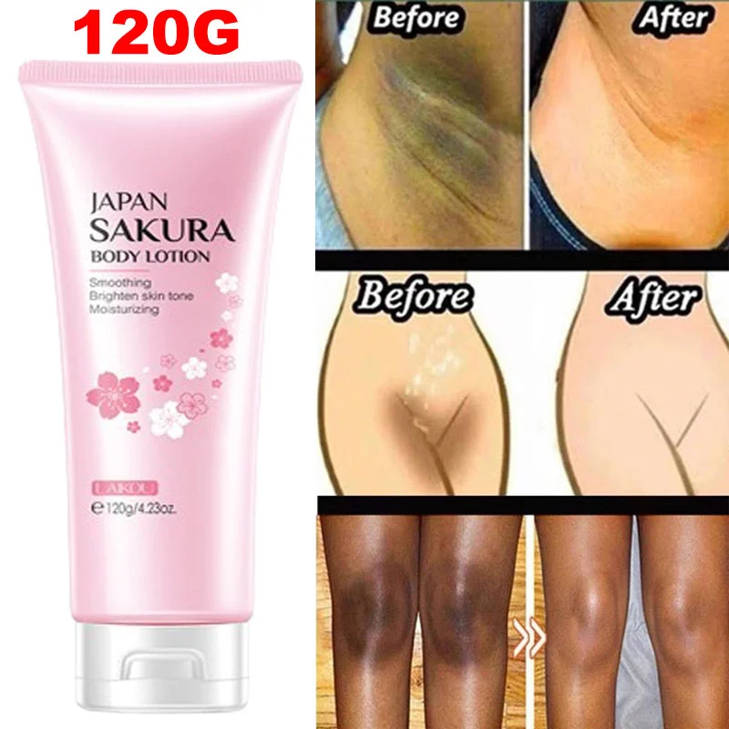 

120g Whitening Cream For Dark Skin Armpit Thigh Inner Joint Lightening Intimate Area Underarm Body Private Parts Brighten Lotion