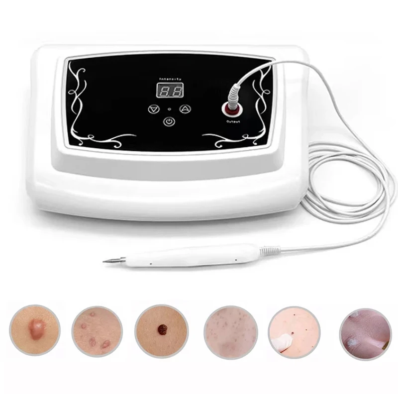 30 Gears Professional Tattoo Mole Removal Pen Laser Plasma Pen Warts Skin Tag Remover Spot Cleaner Skin Tag Removing Machine skin tag removal tool skin tag removal pen laser skin treatment