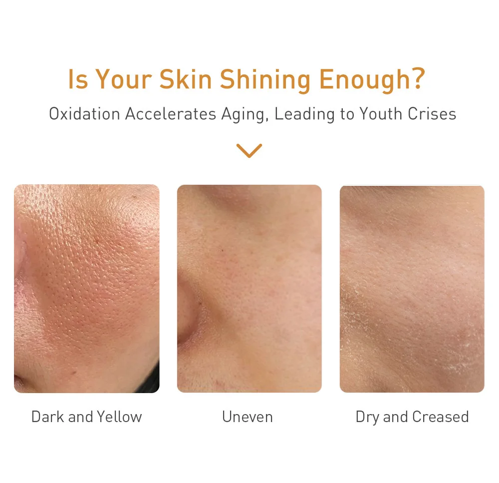 Vitamin C Whiten Serum Brighten Anti-Freckles Remove Melanin Wrinkles Reduce Pigmentation Moisturizing Smooth Skin Care_voghion.com