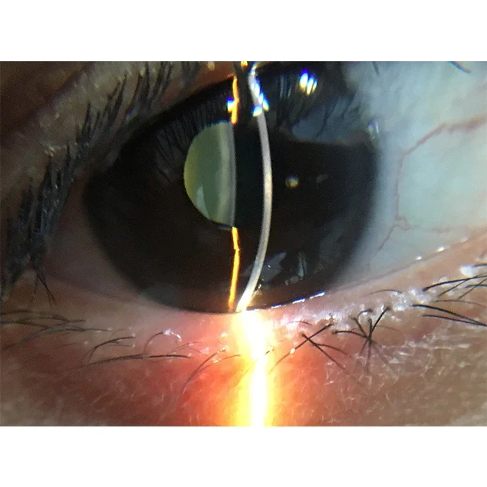 S150D China ophthalmic 6X Portable digital veterinary human slit lamp with APP with mobile adaptor