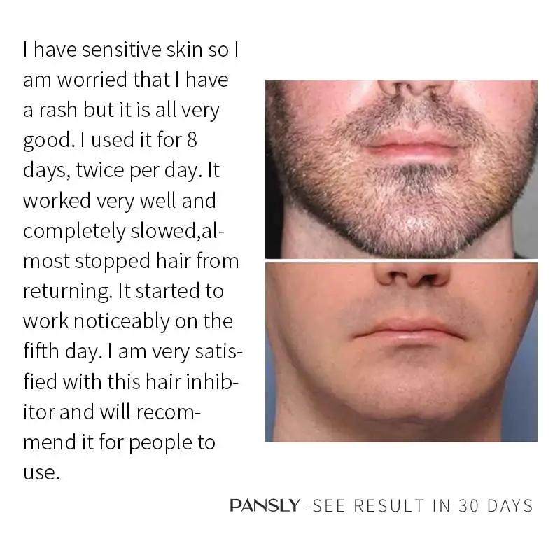 Painful Rash Under Armpit Coupon Codes drive.cloud.mn