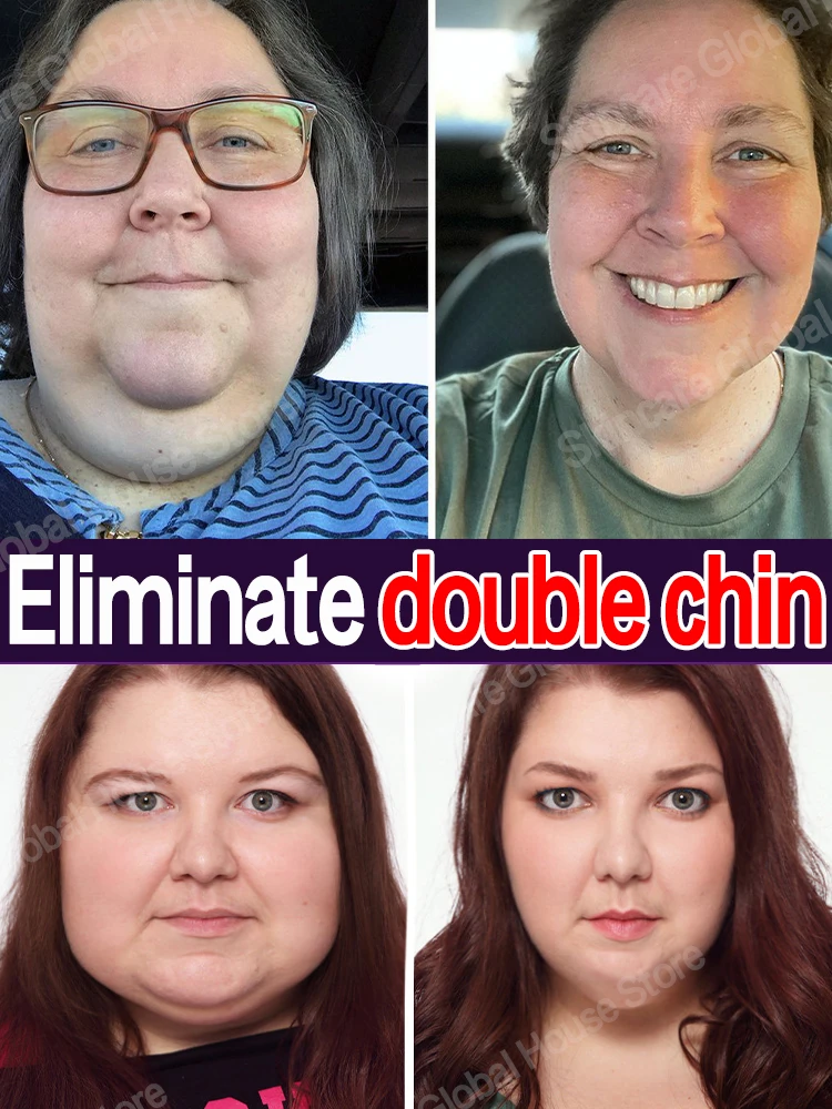

Face Slimming Cream Double Chin V shape