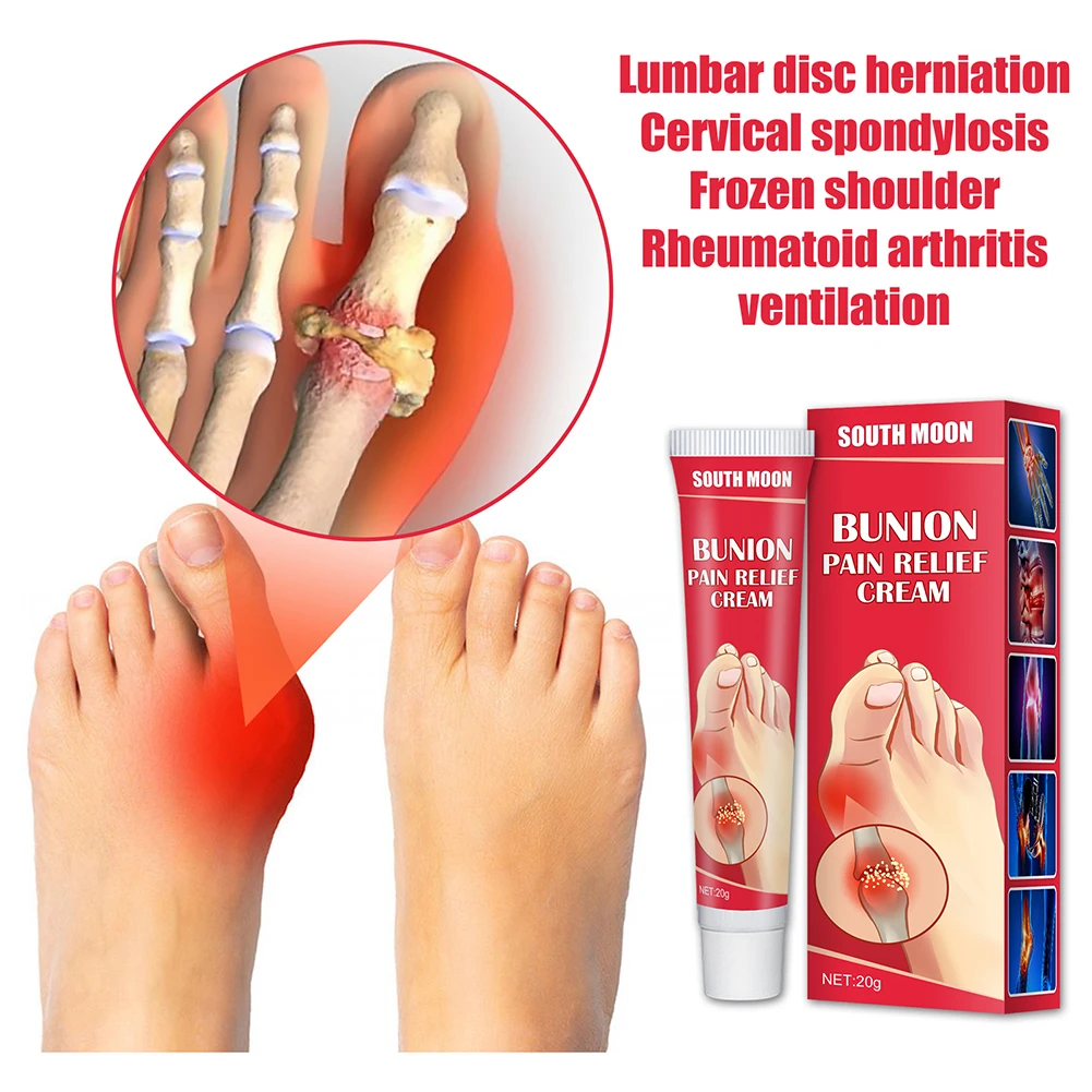 

10/20g Bunion Gout Pain Relief Ointment Toe Joint Valgus Corrector Cream Hallux Knee Lumbar Arthritis Treatment Medical Plaster