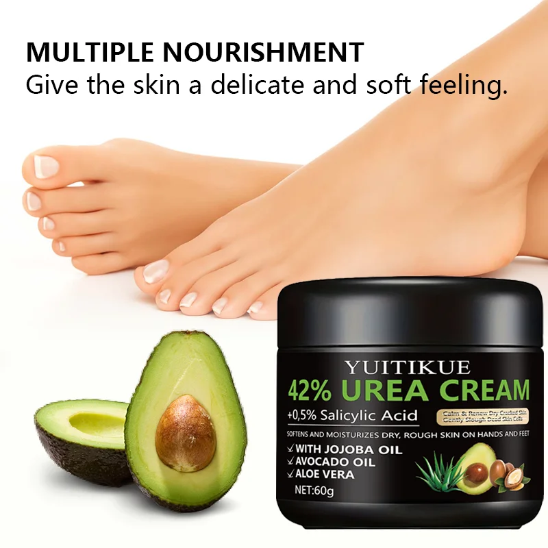 YUITIKUE 42% urea cream, 0.5% salicylic acid, softens and moisturizes dry and rough skin on hands and feet