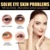 Eelhoe Instant Firming Eye Cream Moisture Replenishment Fade Wrinkles Eye Bags and Dark Circle Tighten Skin Around Eyes 5