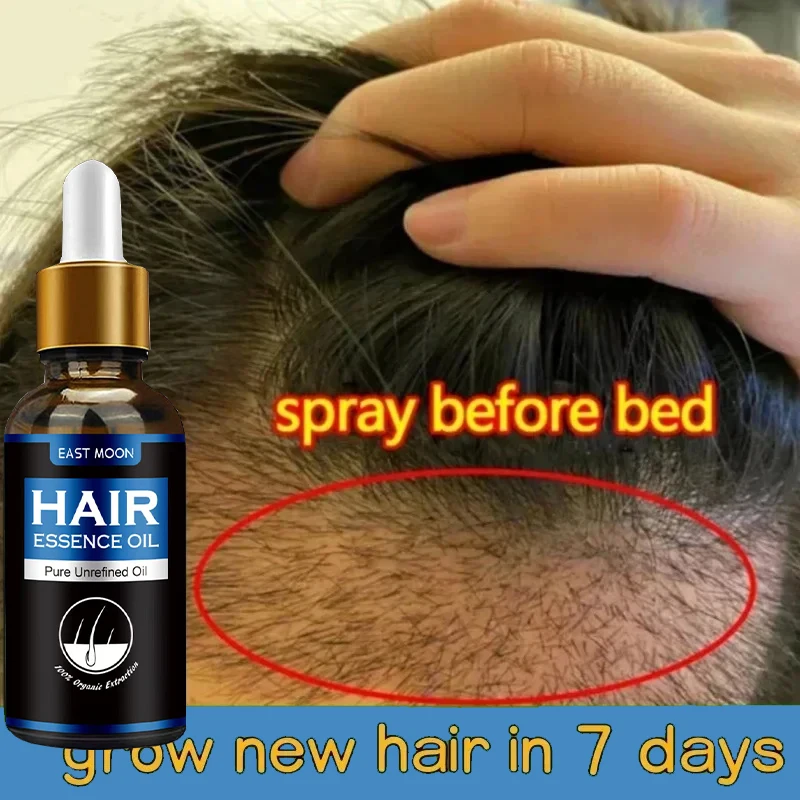 Cultivar el cabello prevenir la p&eacute;rdida de cabello y reducir la p&eacute;rdida de cabello y rotura