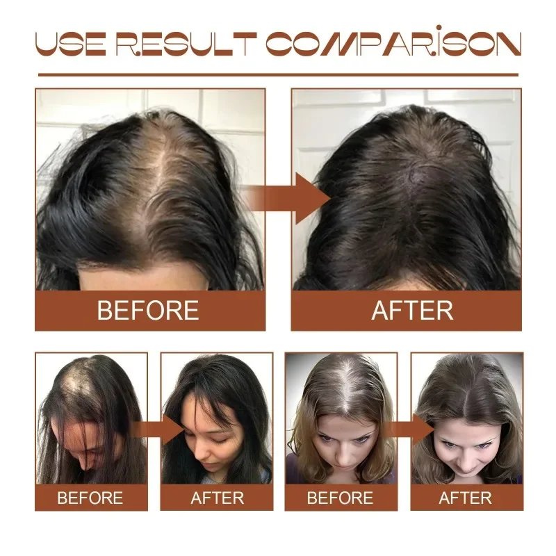Natural 100% Pure Batana Oil Butter Hair Mask Anti Break Loss Hair Growth From Honduras Loss Treatment for Black Men Women hair mask