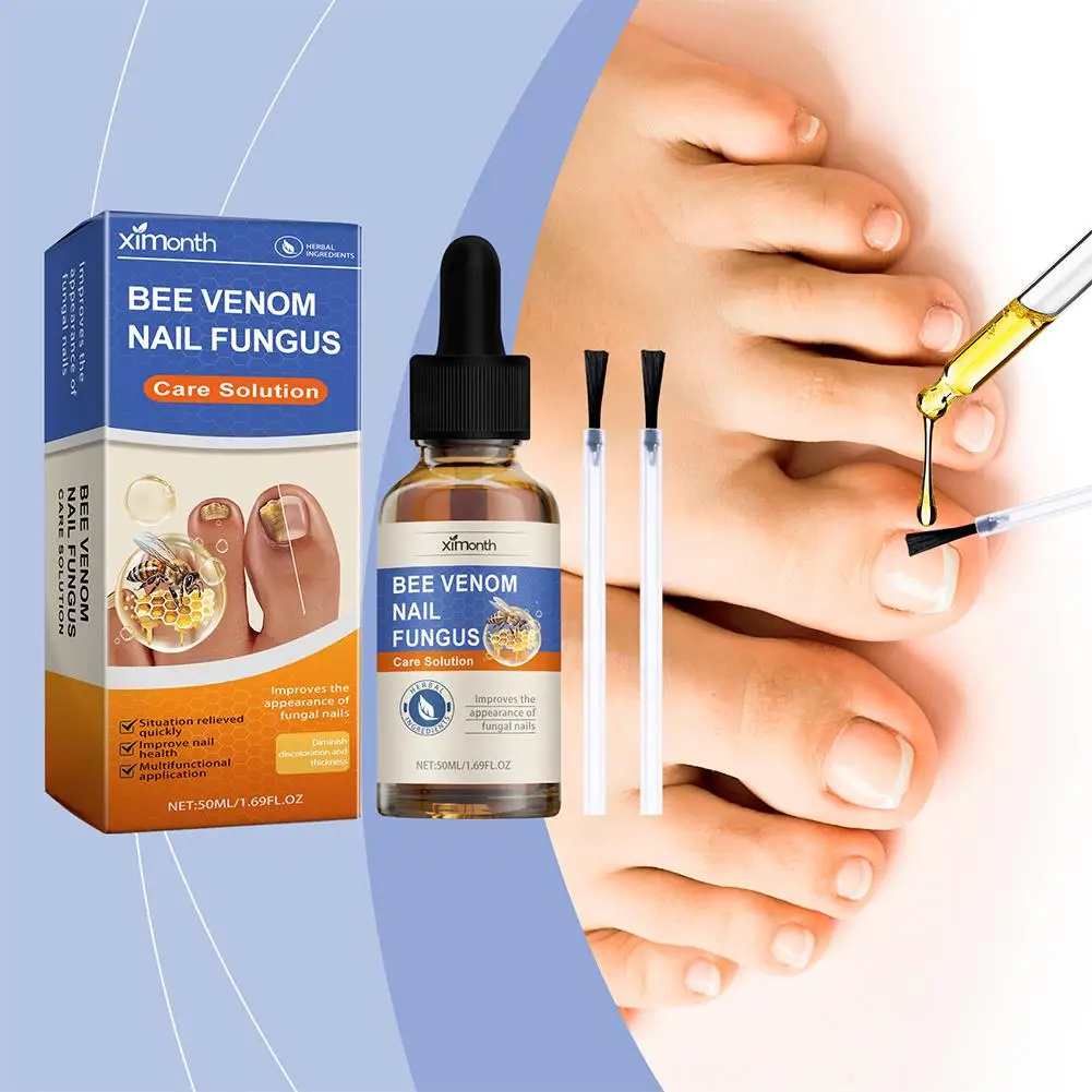 Nail Repairing Liquid Fungus Treatment Essence Care Fungal Gel Paronychia Anti-infective Foot Removal Hand Repair M7C3 50ml