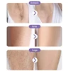 Crystal Epilator Laor Hair Removal Gum Hot Crystal Physical Eraser Painless Epilator Easy Cleaning Reusable Body Care 2