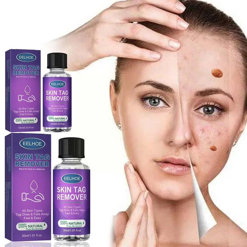 

2023 Wart Remover Liquid Anti Verruca Remedy Liquid And Quickly Mole Care Painless Skin Wart Remover Skin Skin Remove Tag L I7S5