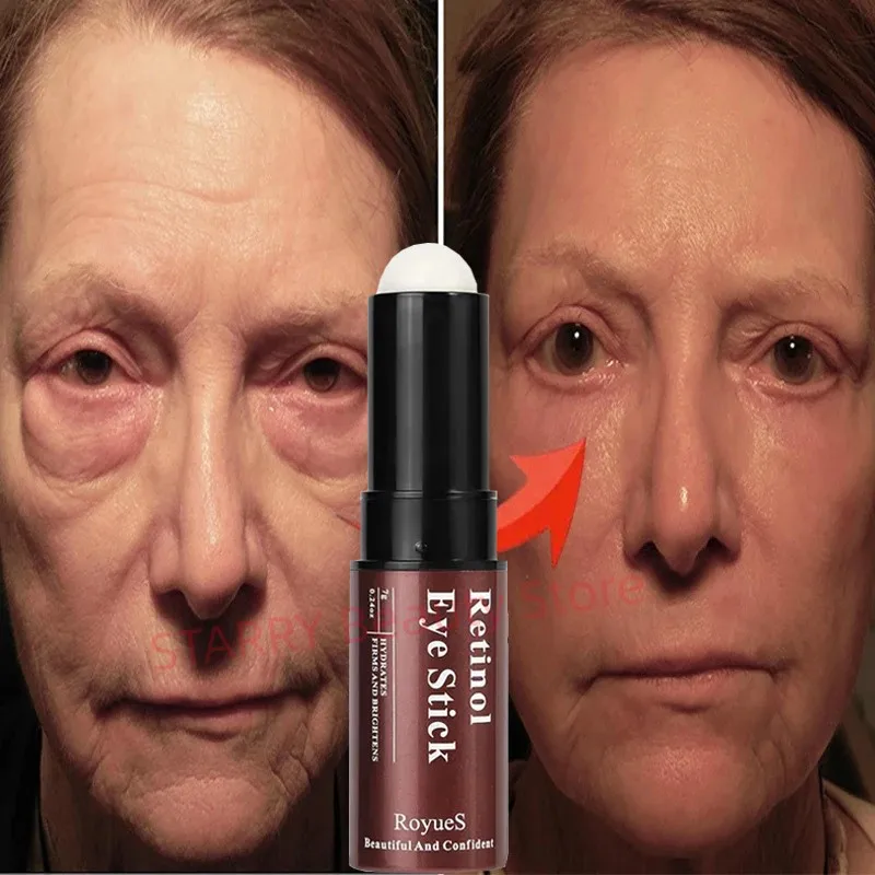 

Instant Eye Bag Remove Eye Cream Anti Fat Particles Dark Circles Puffiness Fade Fine Lines Lift Brighten Korean Beauty Eye Care