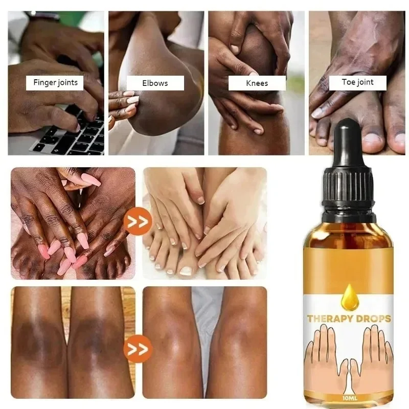 Brightening Serum Bleaching Moisturizing Underarm Knuckles Knee Inner Thigh Wh-itening Cream Removal Dark-Spots Lighten Dullness 6