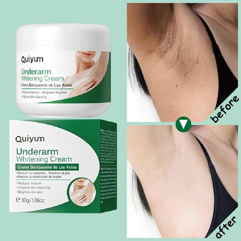 

Underarm Body Whitening Cream Legs Knee Elbow Armpit Bleaching Cream Improve Dull Remove Dark Spots Melanin Brighten Skin Care