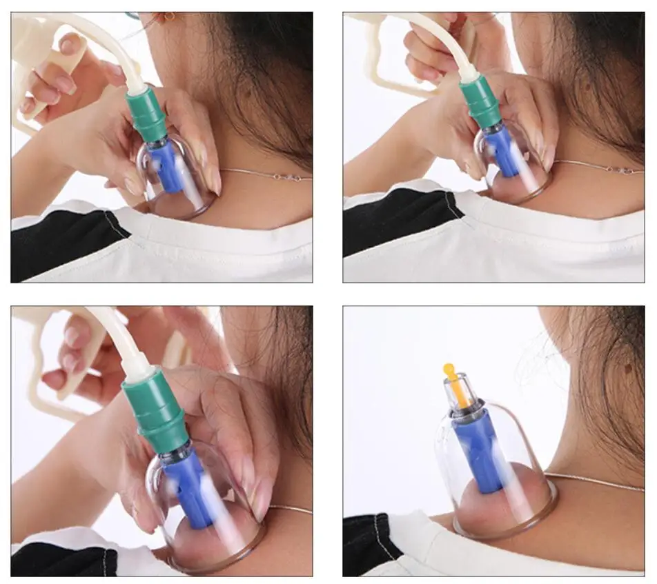 Description Picture 6 of item32 Pieces Vacuum Cupping Cup Body Massager Suction Cups Set Plastic Vacuum Cupping Pump Therapy Cans for Massage Health Care