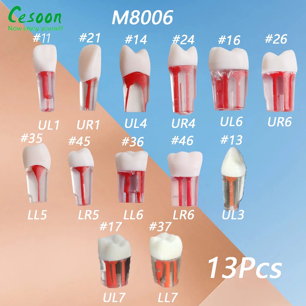 Rct Endo Block Sa22397ff843141cc9dbe213e3efba947f.png
