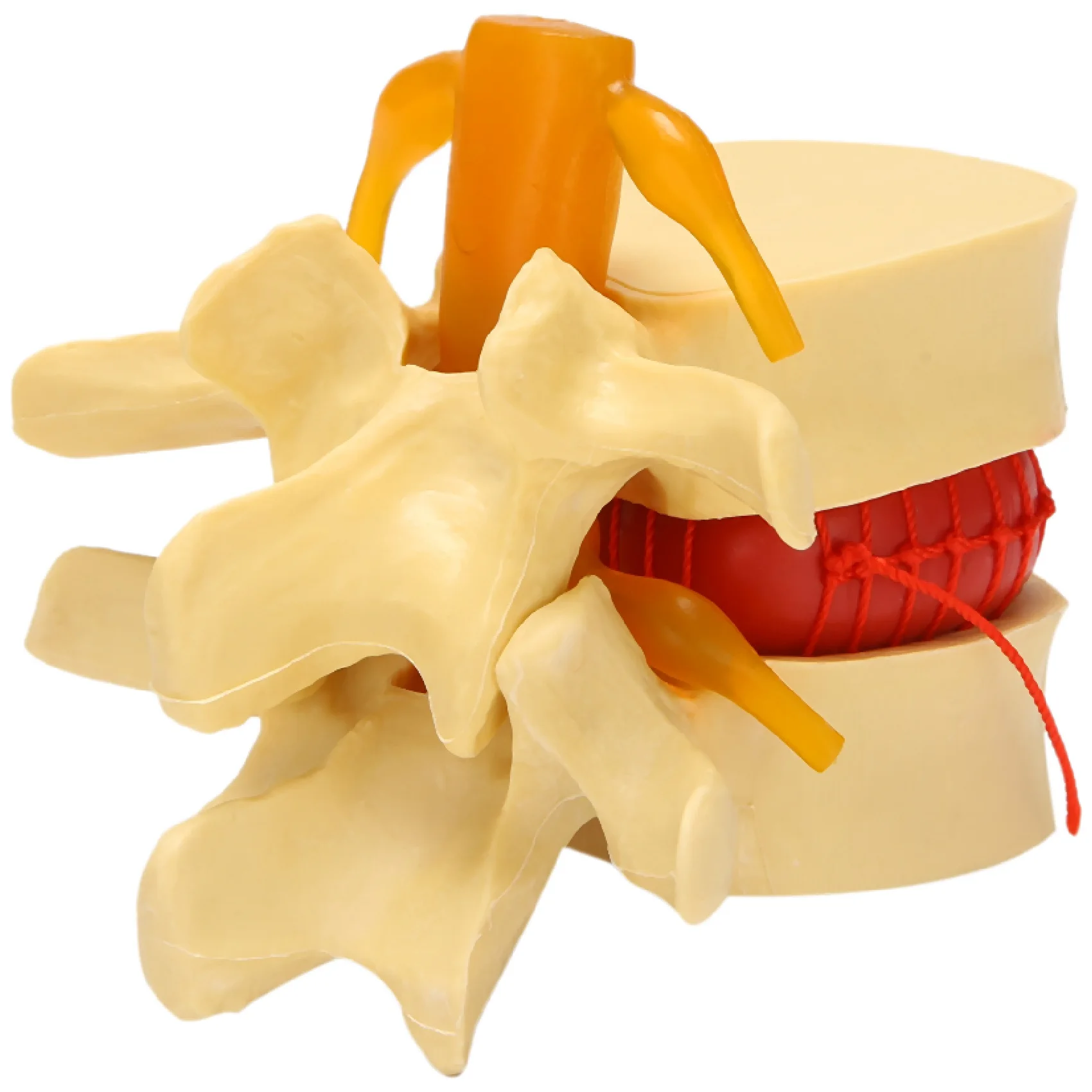 

Lumbar Vertebrae Model Anatomical Spine Lumbar Disc Herniation Anatomy Teaching Tool Lumbar Vertebrae