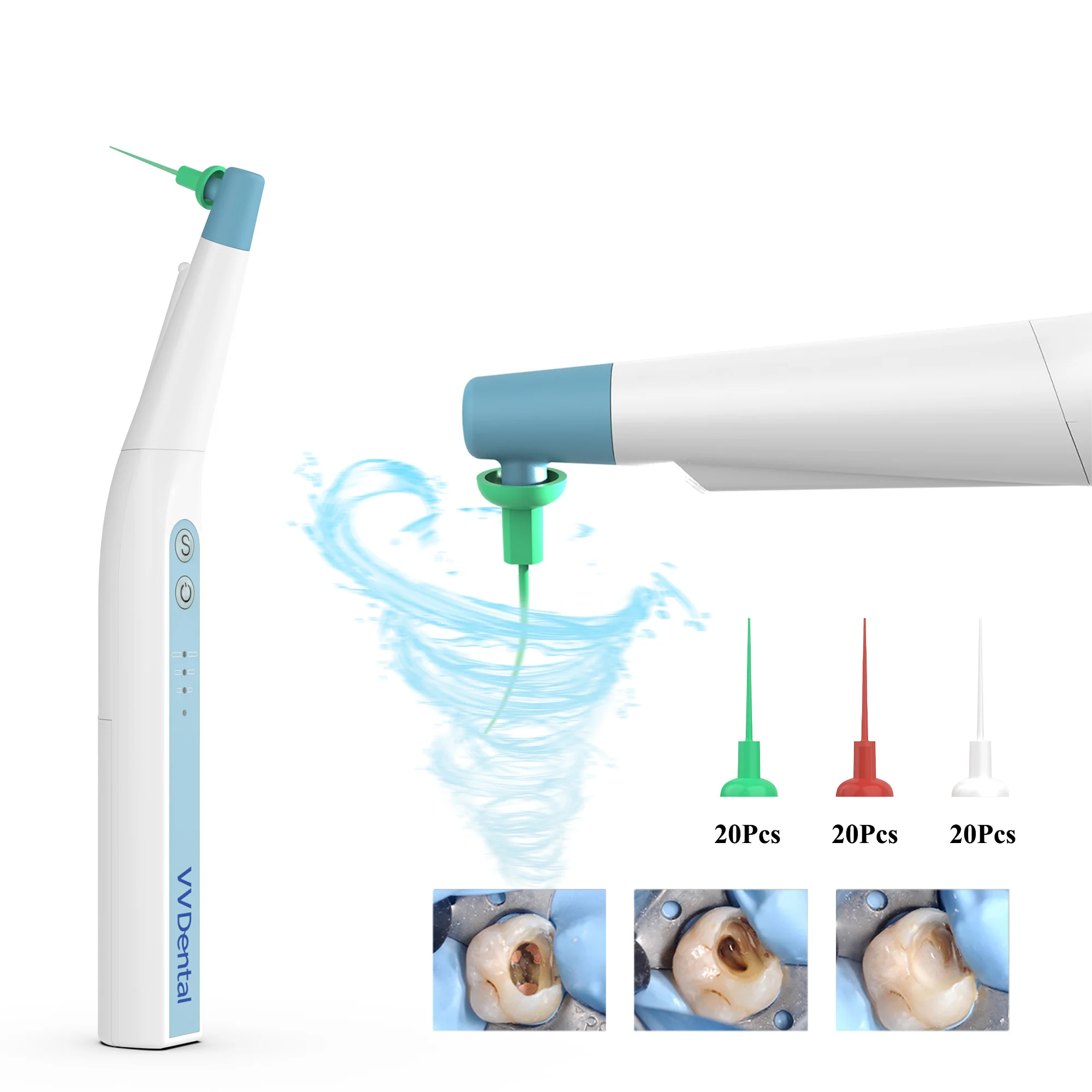 Activador ultrasónico dental LED Endo Irrigador sónico para conducto