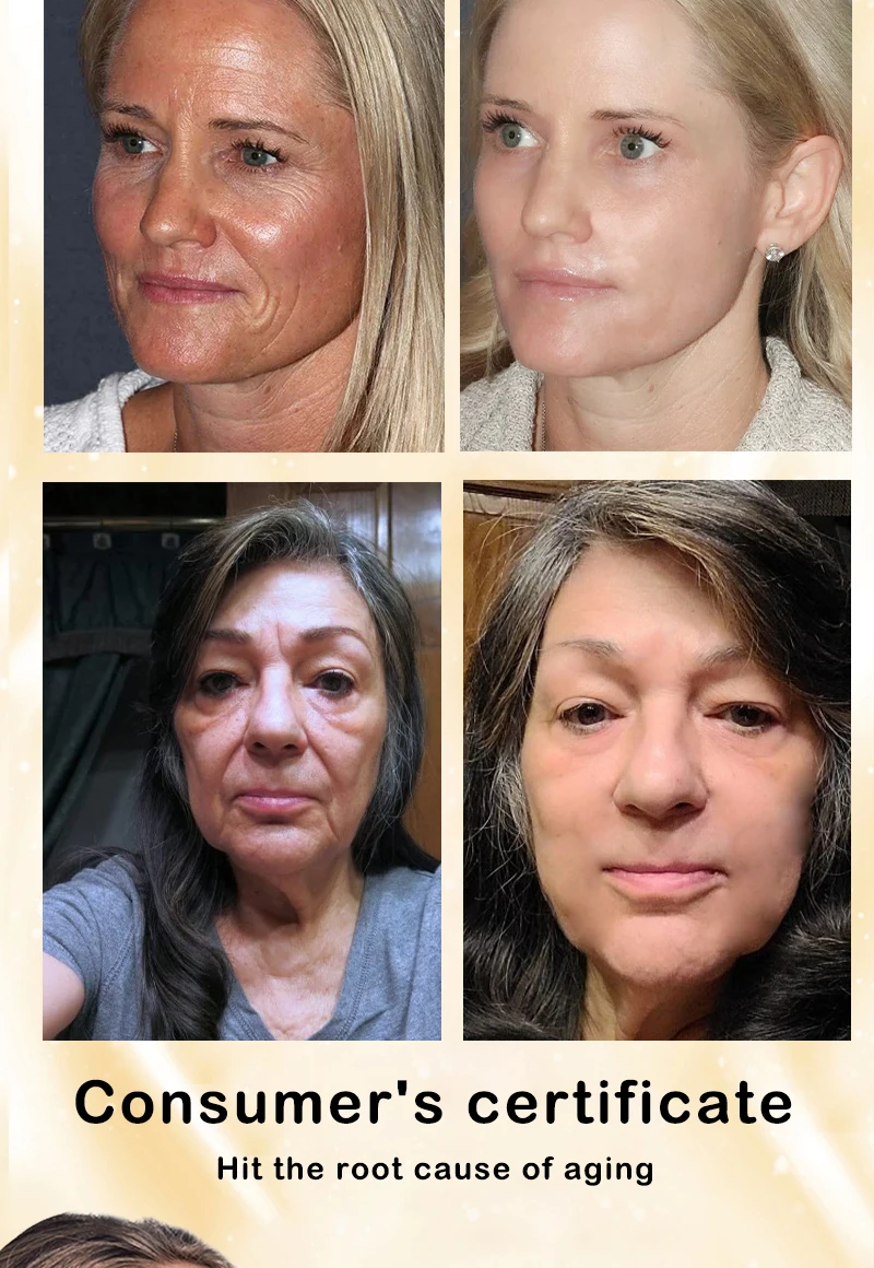 No Fine Lines ,For Wrinkles And Does Not Look Old_voghion.com