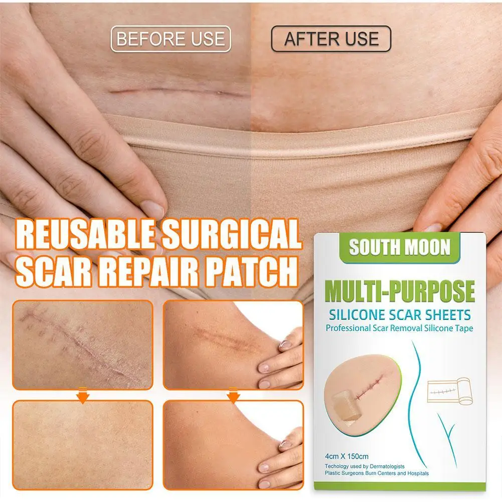 Silicone Surgical Scar Removal Patch Remove Trauma Burn Sheet Skin Repair Scar Removal Therapy Patch For Acne Treatment