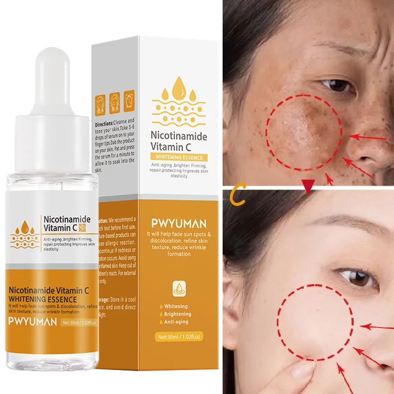 

Vitamin C Whitening Serum Remove Freckle Dark Spot Repair Essence Fade Melanin Improve Dull Anti-Aging Moisturizing Skin Care