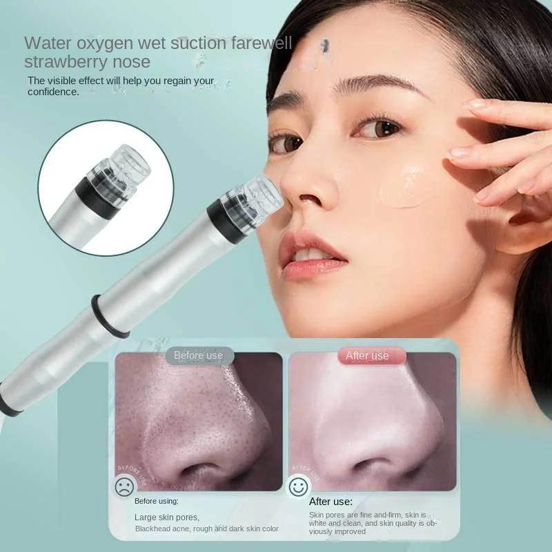 Small Bubble Beauty Device, Facial Blackhead Deep Cleaning Device,home Oxygen Injection Device,beauty Salon Specific Instrument