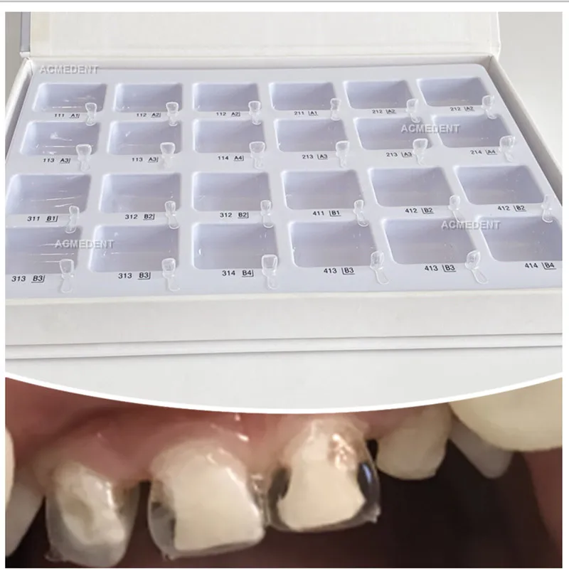 Dental Kids Strip Teeth Crown Formpedo Child Crowns Anterior Transparent Orthodontic