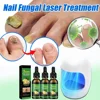 Nail Fungus Treatment Device Foot Toe Nails Fungal Repair Serum Anti Infection Gray Nails Onychomycosis Paronychia Remove Tools 4
