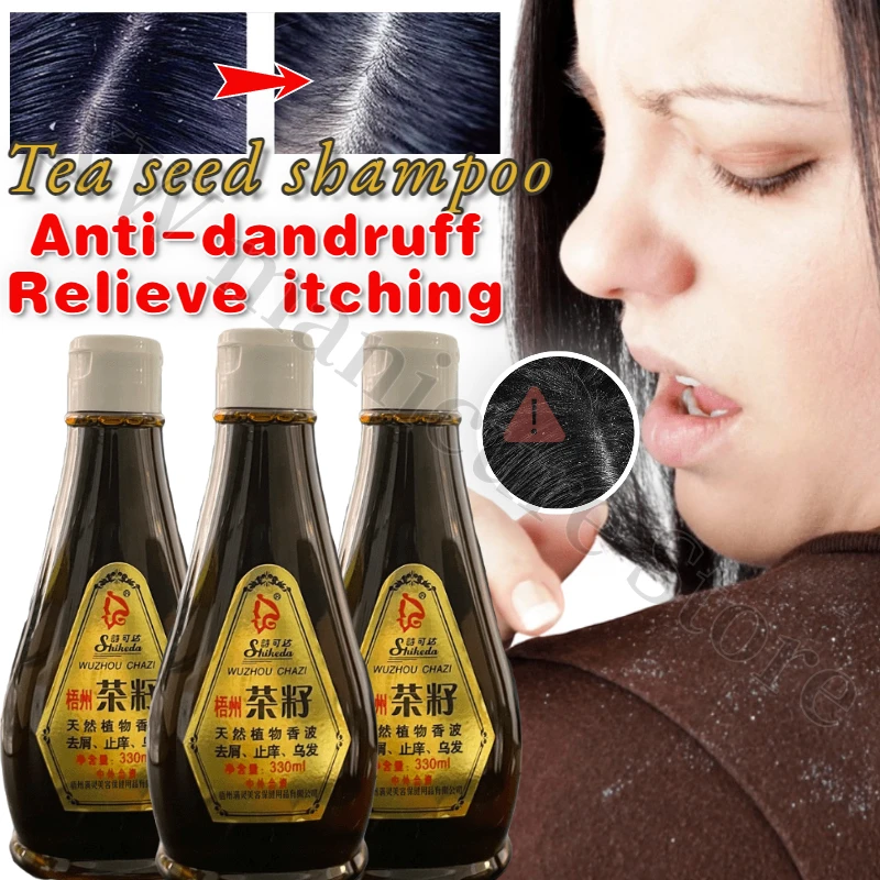 Repair Scalp Remove Dandruff Anti-itch Oil Control Shampoo Pure Plant Extract No Additives Natural Tea Seed Shampoo 330ML