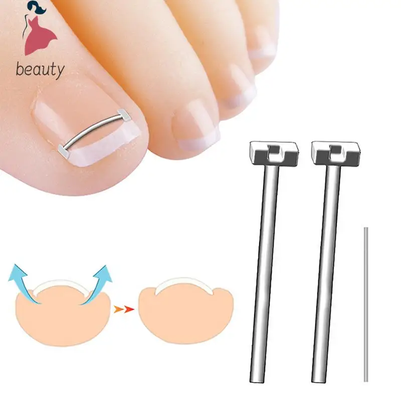 

Ingrown Toenail Corrector Tools Pedicure Recover Embed Toe Nail Treatment Professional Ingrown Toenail Straightening Clip Tool
