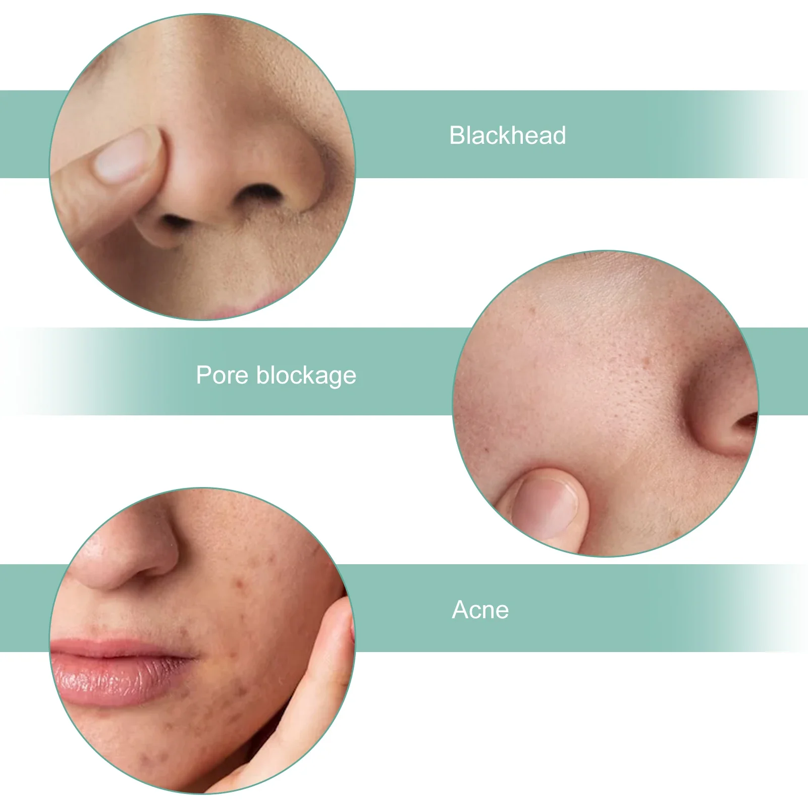 Facial Skin Scrubber Ultrasonic Shovel Cleaner Dead Skin Peeling Cavitation Face Deep Cleaning EMS Lifting Blackhead Remover