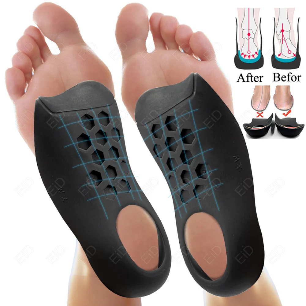 EiD Orthesen Einlegesohlen für XO-Beine Korrektur Orthopädische Flache Füße Ferse Schmerzen Arch Unterstützung Für Mann Frau Schuh Einlegesohlen sohle Einsatz – Detail 16