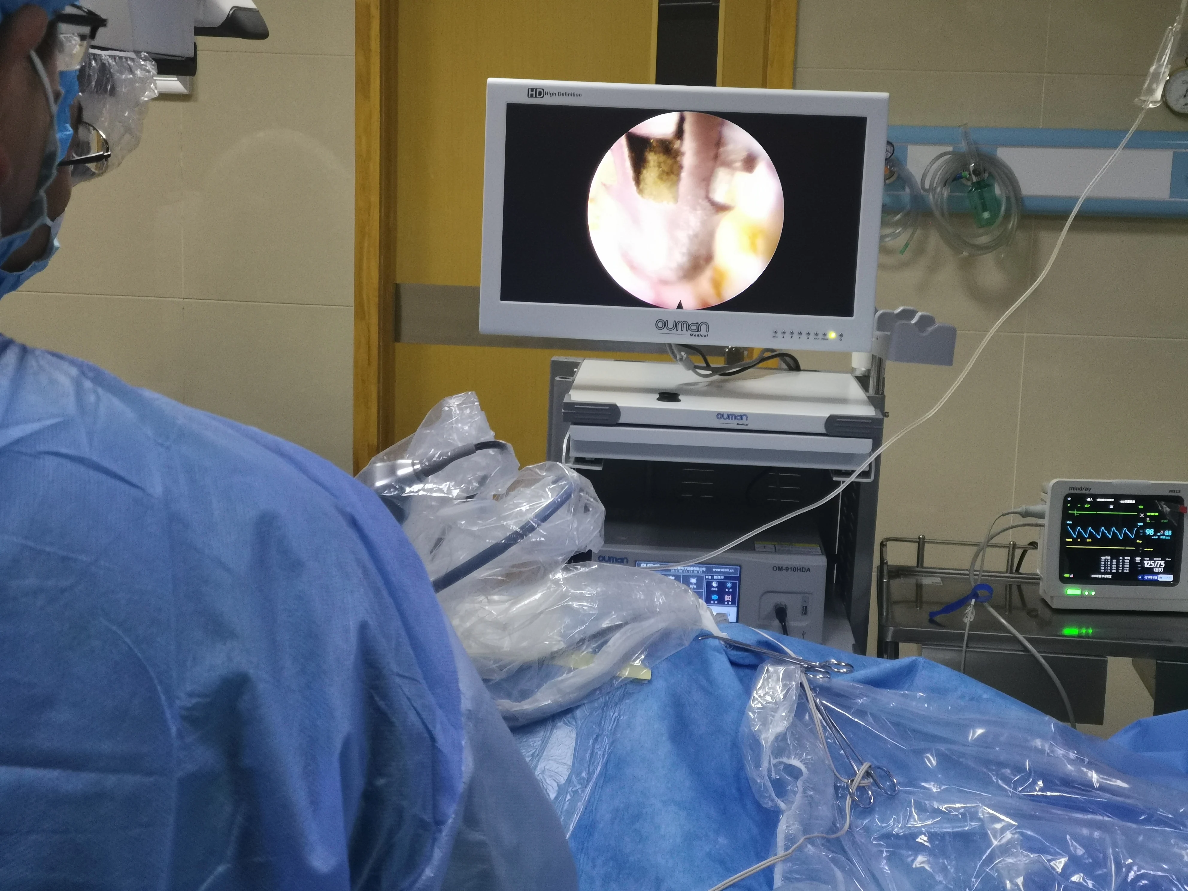 Рисунок 6 - Эндоскопическая камера UHD 910HDC