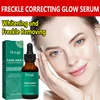 Dark Spot Remover Serum For Face Sun Melasma Freckles Pigment Age Spots Removal Freckle Whitening 1