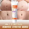 44716-c441c9.jpg Stretch Mark Repair Cream – Firm, Smooth & Restore Skin