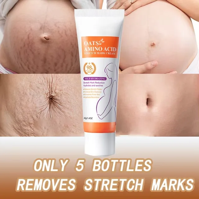 44716-c441c9.jpg Stretch Mark Repair Cream – Firm, Smooth & Restore Skin