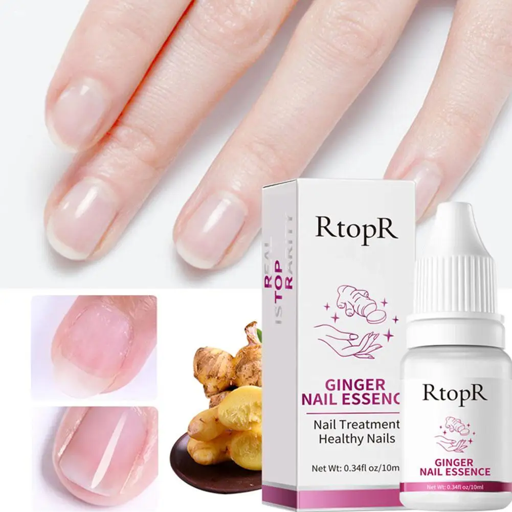

10ml Ginger Nail Polish Nail Treatment Fungal Nail Fungal Promote Repair Infection Anti Nail Nail Growth Rough Nail Repair T9O1