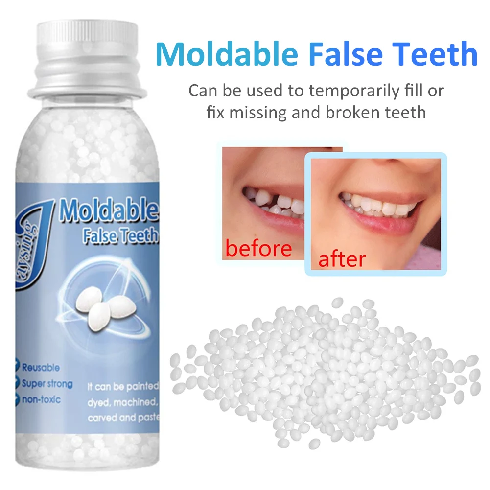Tooth Repair Granules, Cavity Filler for Teeth, Tooth Repair Kit for  Chipped Teeth, Moldable False Teeth, Cavity Filler for Teeth, Temporary  Filling for Tooth (1pcs) : : Health & Personal Care