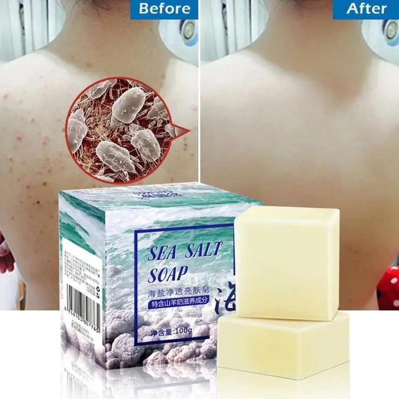 

Sea Salt Soap whitening Moisturizing Soap Natural Milk Salt Sea Soap Pimple Care Remove Treatment Face Pores Foaming Acne N P5C3