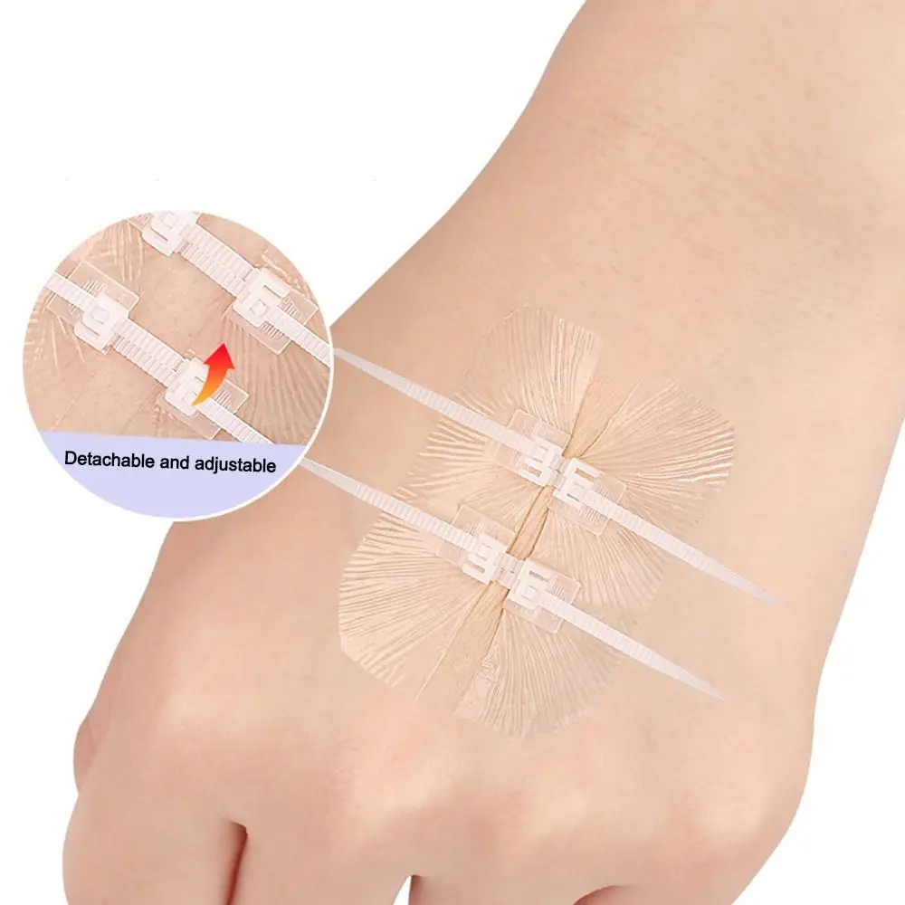 Adhesive Wound Care Zip Sutures Bandaids First Aid Without Stitches Emergency Wound Closures Emergency Zipper Laceration Repair