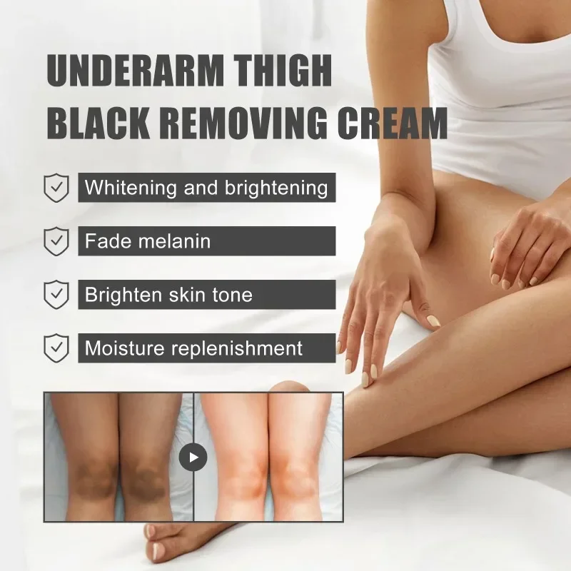 

Sdatter Whitening Cream Private Parts Underarm Bleaching Serum Whiten Butt Knee Brighten Inner Thigh Intimate Parts Dark Remove