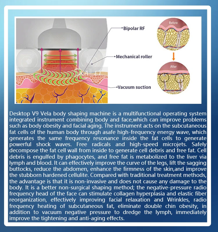 VelaShape Machine 5 In 1 For Body Contouring 10 <h3 class="features--headline">Features and benefits</h3> VelaShape is a non-invasive procedure that doesn't require surgery or downtime. VelaShape can help contour the body by reducing fat in targeted areas. VelaShape reduce the cellulite and improve the texture and tone of the skin VelaShape can help tighten sagging skin and improve skin laxity <hr /> <h5></h5> <h5><span class="tw-text-2xl tw-font-bold" style="color: #99ccff;">IN STOCK READY TO SHIP</span></h5> <h5><span class="tw-text-2xl tw-font-bold" style="color: #99ccff;">1 YEAR WARRANTY + 3 YEAR TECH SUPPORT</span></h5> <h5><span class="tw-text-2xl tw-font-bold" style="color: #99ccff;">30 DAY MONEY-BACK AND <a href="https://salonmachines.com/refund_returns/">RETURN POLICY</a></span></h5> <h5><span class="tw-text-2xl tw-font-bold" style="color: #99ccff;">FREE WORLDWIDE SHIPPING <a href="https://salonmachines.com/shipping-policy/">SHIPPING POLICY</a> </span></h5> <h5><span class="tw-text-2xl tw-font-bold" style="color: #99ccff;">PROFESSIONAL BEAUTY <a href="https://salonmachines.com/">SALON MACHINES</a> EQUIPMENT</span></h5> <div class="product-block product-block--sales-point"></div> VelaShape Machine 5 In 1 For Body Contouring