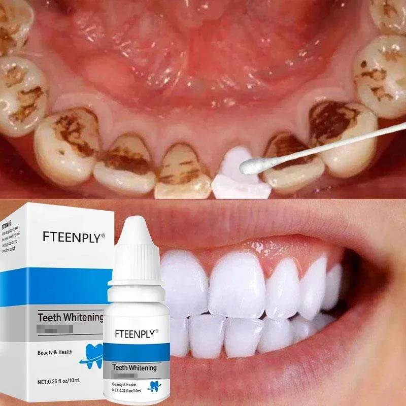 Teeth Serum