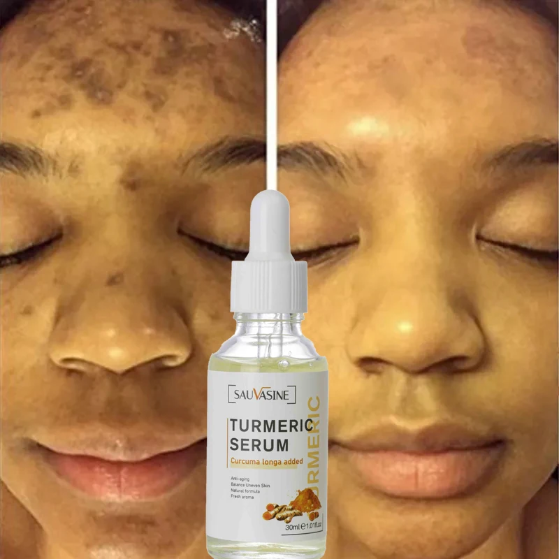 

Сыворотка для лица с куркумой для отбеливания темных точек, 30 мл