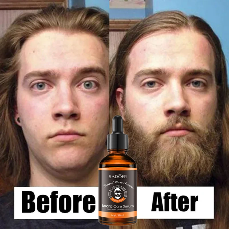 Growth Beard Oil For Men Beard Thicker & More Full Thicken Hair Beard