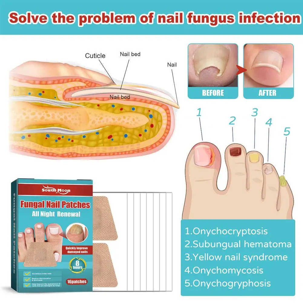Nail Fungus Remover Toenail Fungus Treatment Nail Patches Anti Fungal Nail Correction Patch