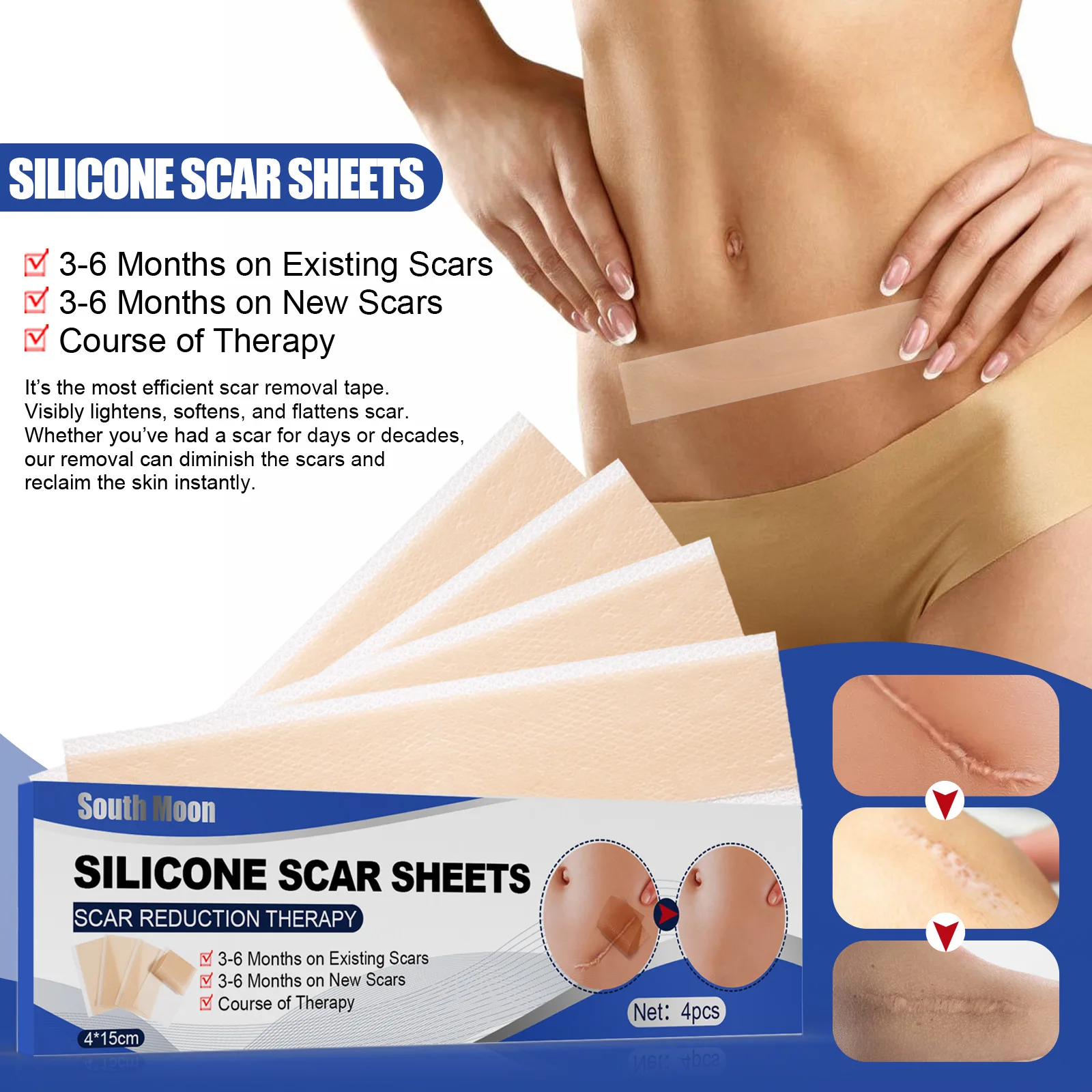 

Efficient Surgery Scar Removal Silicone Gel Sheet Therapy Patch for Acne Trauma Burn Scar Skin Repair Scar Treatment