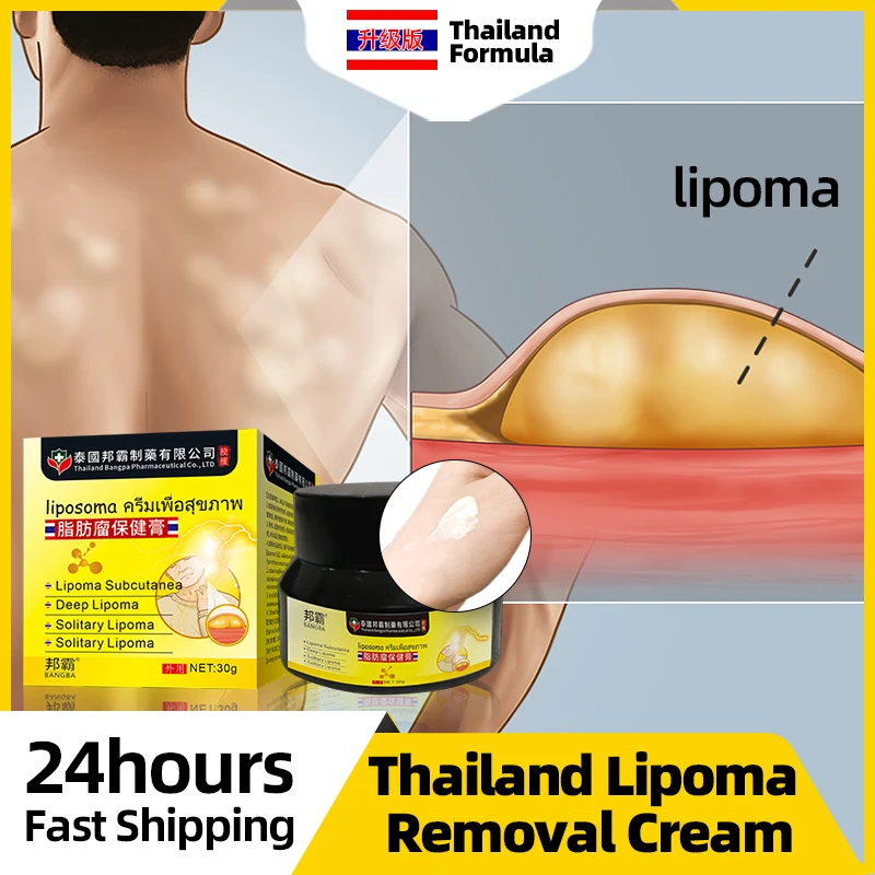 

Lipoma Removal Cream Fat Lump Fibroma Cellulite Treatment Ointment Fat Mass Remover Lipomas Cyst Thailand Formula Medicine
