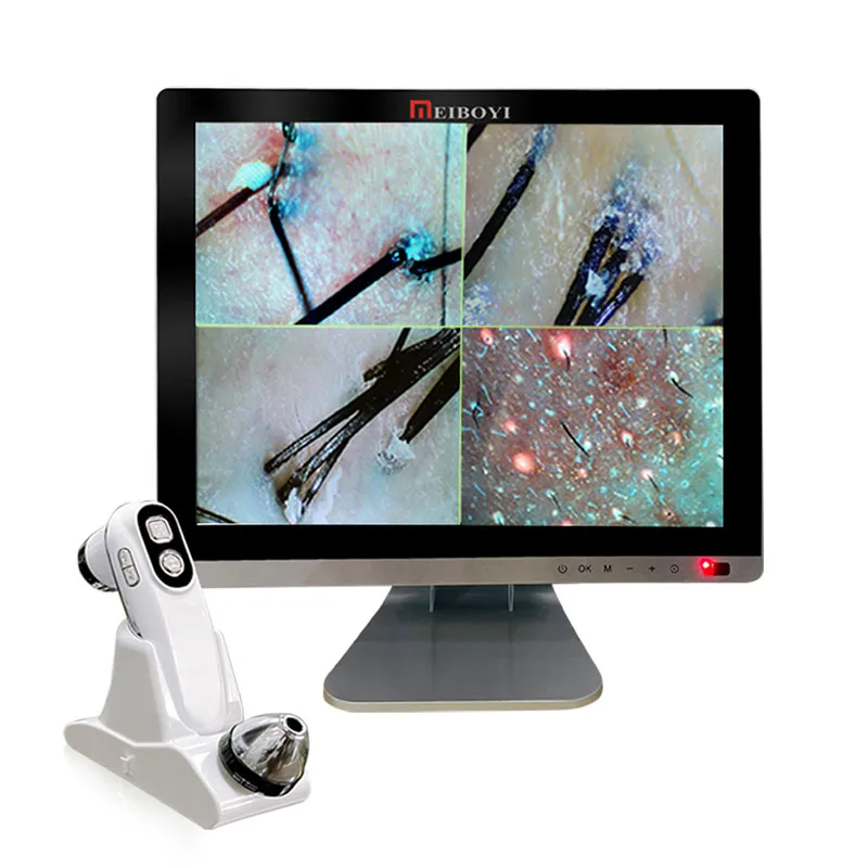 15inch LCD Skin&Hair Analyzer Detector Digital Microscope Magnifier Skin Hair Blackhead Follicle Scalp Detector 50X-200X