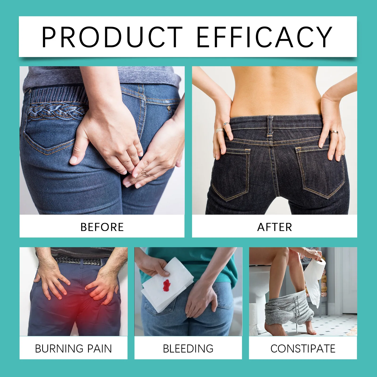 Hemorrhoids Treatment Spray Piles Pain Anal Fissure Swell Bleeding Internal External Mixed Hemorrhoids Removal Anti Inflammatory